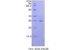 SDS-PAGE analysis of Mouse Laminin beta 2 Protein.