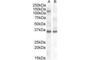 Western Blotting (WB) image for Eukaryotic Translation Initiation Factor 2C, 1 (EIF2C1) peptide (ABIN369314) (Eukaryotic Translation Initiation Factor 2C, 1 (EIF2C1) Peptide)