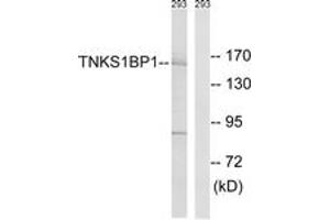 Western blot analysis of extracts from 293 cells, using TNKS1BP1 Antibody. (TNKS1BP1 antibody  (AA 1601-1650))