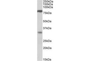 Antibody (1µg/ml) staining of Human Duodenum lysate (35µg protein in RIPA buffer). (CLCA1 antibody  (Internal Region))