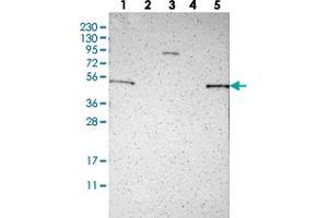 Western blot analysis of Lane 1: RT-4, Lane 2: U-251 MG, Lane 3: Human Plasma, Lane 4: Liver, Lane 5: Liver with KIAA0513 polyclonal antibody  at 1:250-1:500 dilution. (KIAA0513 antibody)