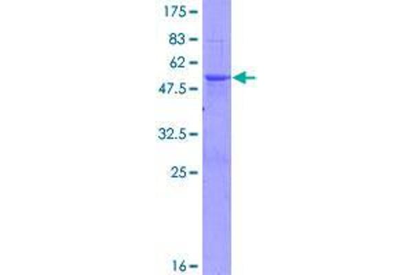 Splicing factor U2AF 26 kDa subunit (U2AF1L4) (AA 1-202) protein (GST tag)