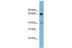 AChE antibody used at 1 ug/ml to detect target protein. (Acetylcholinesterase antibody)