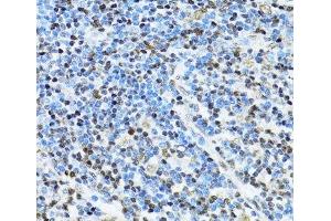 Immunohistochemistry of paraffin-embedded Human appendix using ITGB3BP Polyclonal Antibody at dilution of 1:100 (40x lens). (ITGB3BP antibody)