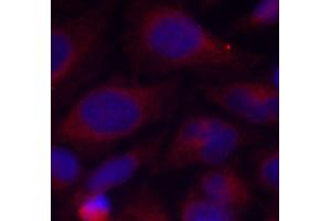 Immunofluorescence staining of methanol-fixed HeLa cells using Phospho-NFKB1-S893 antibody (ABIN2988205). (NFKB1 antibody  (pSer893))