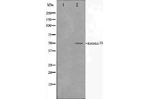Western blot analysis on HeLa cell lysate using Keratin 20 Antibody. (KRT20 antibody  (C-Term))