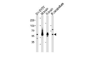 Western blot analysis of lysates from SH-SY5Y cell line, mouse brain, rat brain, rat cerebellum tissue (from left to right), using SYN1 Antibody (C-term) (ABIN1881860 and ABIN2843335). (SYN1 antibody  (C-Term))
