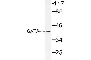 Image no. 2 for anti-GATA Binding Protein 4 (GATA4) antibody (ABIN272192) (GATA4 antibody)