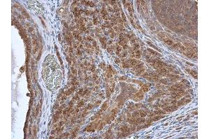 IHC-P Image HAX1 antibody detects HAX1 protein at cytoplasm in rat ovary by immunohistochemical analysis.