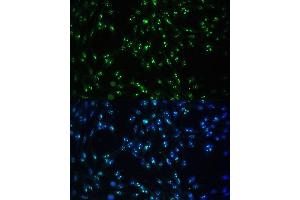 Immunofluorescence analysis of NIH-3T3 cells using CCDC59 antibody (ABIN7266440) at dilution of 1:100. (CCDC59 antibody  (AA 1-241))