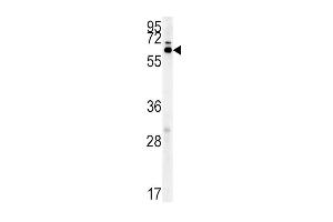 IKZF3 Antibody (Center) (ABIN651843 and ABIN2840420) western blot analysis in mouse liver tissue lysates (15 μg/lane).