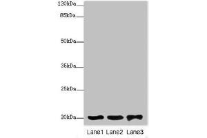 Western blot All lanes: FAIM antibody at 2 μg/mL Lane 1: 293T whole cell lysate Lane 2: Rat gonad tissue Lane 3: Jurkat whole cell lysate Secondary Goat polyclonal to rabbit IgG at 1/10000 dilution Predicted band size: 21, 25, 23 kDa Observed band size: 21 kDa (FAIM antibody  (AA 1-179))