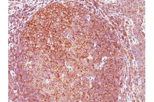 Formalin-fixed, paraffin-embedded human Tonsil stained with BCL10 Mouse Monoclonal Antibody (BL10/411). (BCL10 antibody  (AA 122-168))