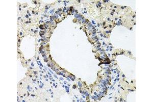 Immunohistochemistry of paraffin-embedded Rat lung using ERBB4 Polyclonal Antibody at dilution of 1:100 (40x lens). (ERBB4 antibody)