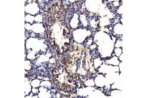 IHC analysis of Gephyrin/GPHN using anti-Gephyrin/GPHN antibody (ABIN7600086).