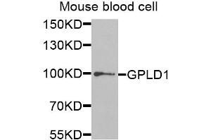 Western blot analysis of extracts of mouse blood, using GPLD1 antibody (ABIN5973975) at 1/1000 dilution. (GPLD1 antibody)