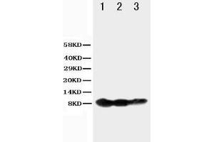 Anti-BAFF Receptor antibody, Western blotting Lane 1: Recombinant Human BAFFR Protein 10ng Lane 2: Recombinant Human BAFFR Protein 5ng Lane 3: Recombinant Human BAFFR Protein 2. (TNFRSF13C antibody  (N-Term))