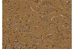 ABIN6276382 at 1/100 staining Rat brain tissue by IHC-P. (TCL1A antibody  (Internal Region))