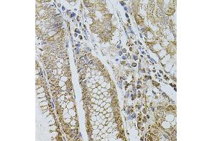 Immunohistochemistry of paraffin-embedded human stomach using SELP antibody (ABIN5974707) at dilution of 1/100 (40x lens). (P-Selectin antibody)