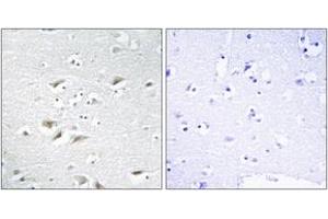 Immunohistochemistry analysis of paraffin-embedded human brain tissue, using ZEB2 Antibody. (ZEB2 antibody  (AA 71-120))