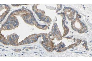ABIN6269186 at 1/100 staining Human prostate tissue by IHC-P. (TNNI3 antibody  (N-Term))