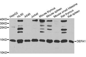 Western blot analysis of extracts of various cell lines, using DEFA1 antibody. (alpha Defensin 1 antibody  (AA 1-94))