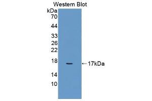 Western blot analysis of the recombinant protein. (Glucose-6-Phosphate Dehydrogenase antibody  (AA 258-350))