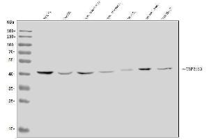 Western blot analysis of TMPRSS3 using anti-TMPRSS3 antibody (ABIN7601198).