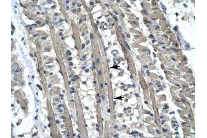 KIF5B antibody was used for immunohistochemistry at a concentration of 4-8 ug/ml to stain Skeletal muscle cells (lndicated with Arrows) in Human Muscle. (KIF5B antibody  (C-Term))