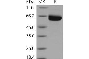 Western Blotting (WB) image for PAK3 (PAK3) (Active) protein (His tag) (ABIN7317075) (PAK3 Protein (PAK3) (His tag))