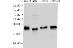 Western Blot analysis of NIH/3T3, K562 cells, Rat spleen and Rat stomach using CDK4 Polyclonal Antibody at dilution of 1:1000