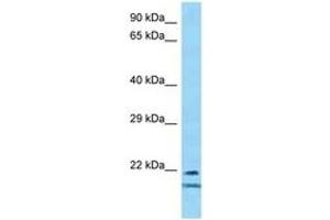 Image no. 1 for anti-Transcription Factor 23 (TCF23) (AA 92-141) antibody (ABIN6748386)