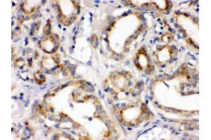 Immunohistochemistry (Paraffin-embedded Sections) (IHC (p)) image for anti-Frizzled Family Receptor 1 (Fzd1) (AA 369-400), (C-Term) antibody (ABIN3042412) (FZD1 antibody  (C-Term))