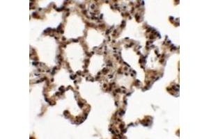 Immunohistochemistry of ECRG2 in rat lung tissue with ECRG2 antibody at 5 ug/mL. (SPINK7/ECRG2 antibody  (C-Term))