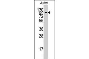 Western blot analysis of ADCY2 polyclonal antibody  in Jurkat cell line lysates (35 ug/lane). (ADCY2 antibody  (C-Term))