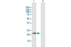 Western Blot analysis of ARL6 expression in transfected 293T cell line by ARL6 MaxPab polyclonal antibody. (ARL6 antibody  (AA 1-186))