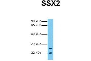 Host:  Rabbit  Target Name:  SSX2  Sample Tissue:  Human Jurkat  Antibody Dilution:  1. (SSX2 antibody  (C-Term))