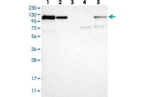 Western blot analysis of Lane 1: RT-4, Lane 2: U-251 MG, Lane 3: Human Plasma, Lane 4: Liver, Lane 5: Tonsil with NFKB2 polyclonal antibody  at 1:250-1:500 dilution.