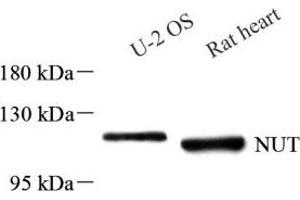 Western blot analysis of NUT (ABIN7074932) at dilution of 1: 1000 (NUT antibody)