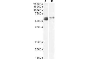 ABIN6391414 (2µg/ml) staining of Human Lung (A) and Skeletal Muscle (B) lysate (35µg protein in RIPA buffer).