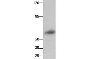 Western Blot analysis of Human liver cancer tissue using FOXJ3 Polyclonal Antibody at dilution of 1:800 (FOXJ3 antibody)