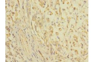 Immunohistochemistry (IHC) image for anti-Claudin 18 (CLDN18) (AA 20-80) antibody (ABIN6038124) (Claudin 18 antibody  (AA 20-80))