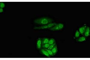 Immunofluorescent analysis of HepG2 cells using ABIN7167799 at dilution of 1:100 and Alexa Fluor 488-congugated AffiniPure Goat Anti-Rabbit IgG(H+L) (Retinoic Acid Receptor beta antibody  (AA 1-85))