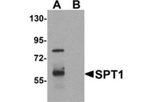 Western blot analysis of TYW3 in A549 cell lysate with TYW3 antibody at 1 μg/ml in (A) the absence and (B) the presence of blocking peptide.