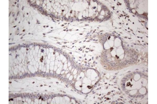 Amelotin antibody