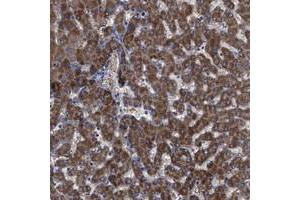 Immunohistochemical staining of human liver with GPR179 polyclonal antibody  shows distinct cytoplasmic positivity in hepatocytes at 1:200-1:500 dilution. (GPR179 antibody)