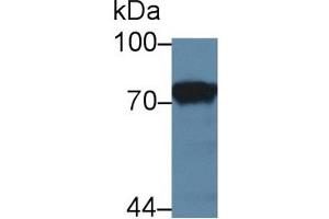Detection of F1+2 in Rat Kidney lysate using Polyclonal Antibody to Prothrombin Fragment 1+2 (F1+2) (Prothrombin Fragment 1+2 antibody  (AA 44-323))