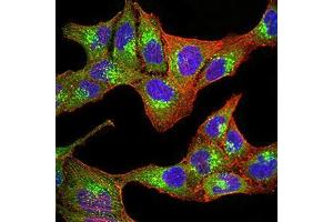 Immunocytochemistry (ICC) image for anti-Progesterone Receptor Membrane Component 1 (PGRMC1) (AA 1-195) antibody (ABIN5873919) (PGRMC1 antibody  (AA 1-195))