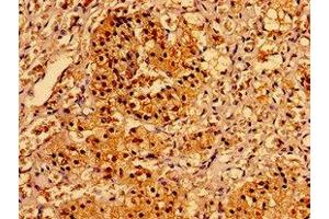 Immunohistochemistry of paraffin-embedded human adrenal gland tissue using ABIN7143732 at dilution of 1:100