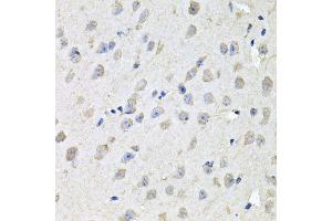 Immunohistochemistry of paraffin-embedded mouse brain using CHCHD3 antibody (ABIN5995784) at dilution of 1/100 (40x lens). (CHCHD3 antibody)